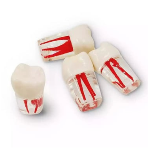 Fuji Endodontik Kronlu Kanallı Dişler